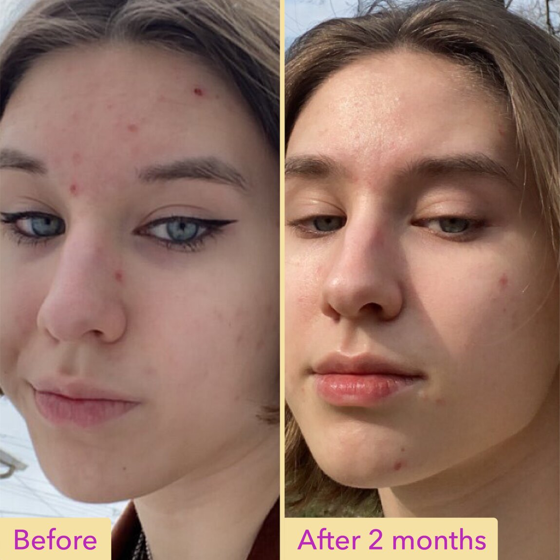 niacinamide-serum-y8 zb_p.jpg
