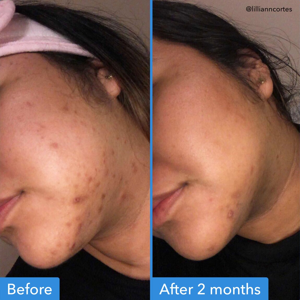 discoloration-correcting-serum-f6 zb_p.jpg