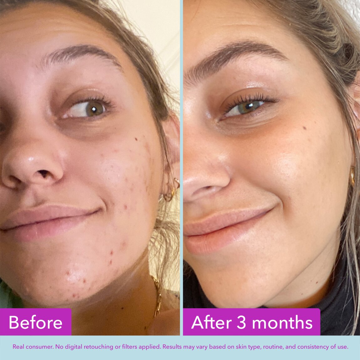 niacinamide-brightening-toner-i5 zb_p.jpg