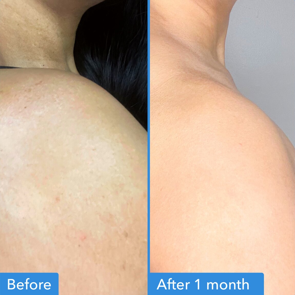 discoloration-correcting-body-treatment-k6 zb_p.jpg